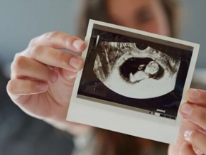 Mujer sosteniendo una imagen por ecografía